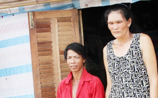 Người phụ nữ Bạc Liêu cao hơn 2m, không dám đi cùng chồng vì sợ chê cười Ảnh 2