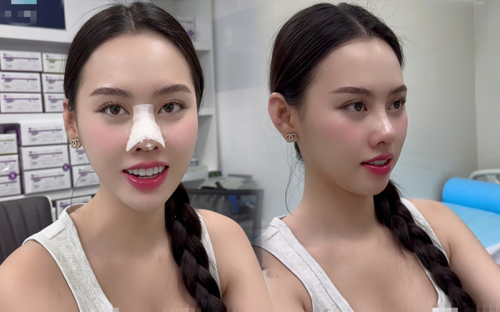 Á hậu Việt can thiệp thẩm mỹ, nhan sắc lai Thanh Thủy và Ngọc Hằng Ảnh 2