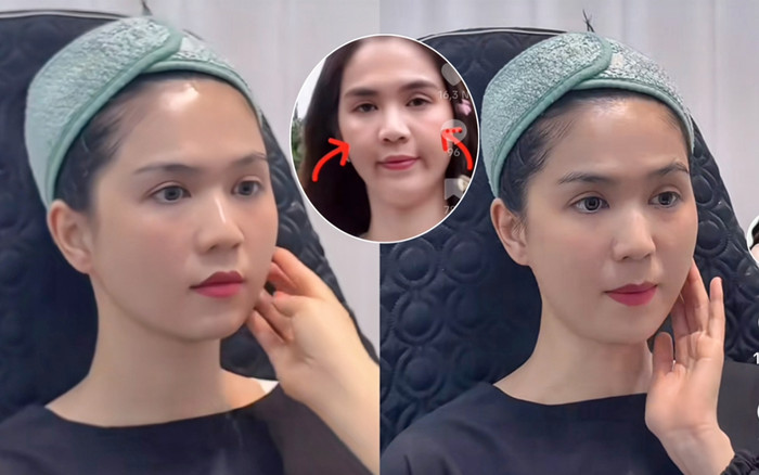 Vừa bị một bác sĩ chê nhan sắc, Ngọc Trinh liền chi chục triệu để thẩm mỹ Ảnh 2