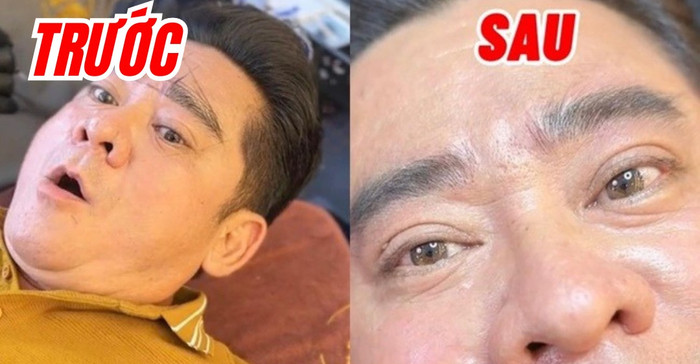 Huỳnh Anh Tuấn trẻ trung trông thấy hậu chỉnh sửa lại phần chân mày.