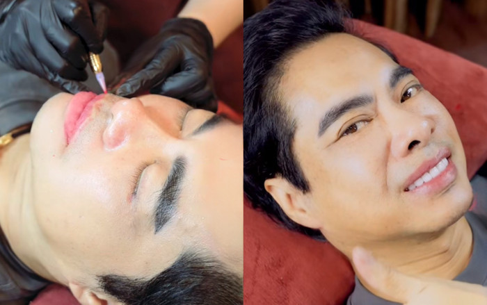 Ca sĩ Ngọc Sơn trùng tu nhan sắc ở tuổi U60 Ảnh 2