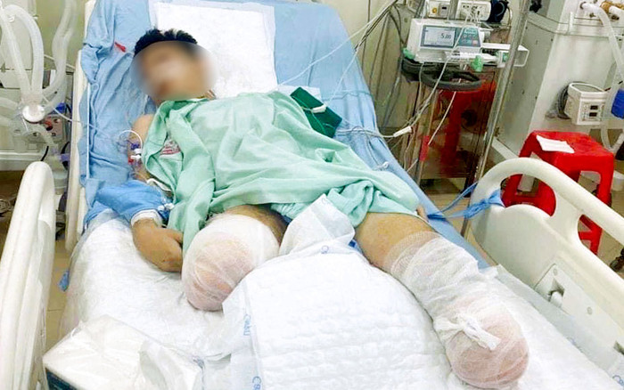 Nam sinh được đặc cách tốt nghiệp THPT vì tai nạn giao thông mất đôi chân Ảnh 2