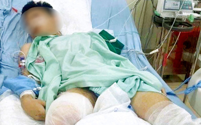 Hoàn cảnh đáng thương của nam sinh được đặc cách tốt nghiệp THPT vì tai nạn Ảnh 2