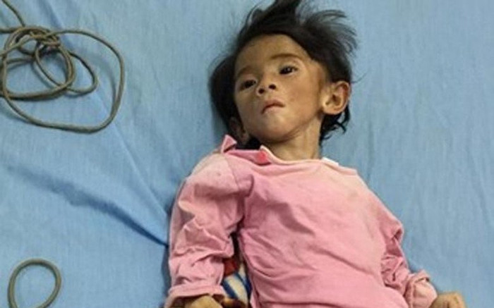 Bé gái chỉ có 'da bọc xương', trông như cụ già được cô gái trẻ nhận nuôi giờ ra sao? Ảnh 2