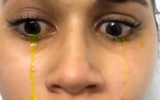 Cô gái khóc ra nước mắt vàng Ảnh 2