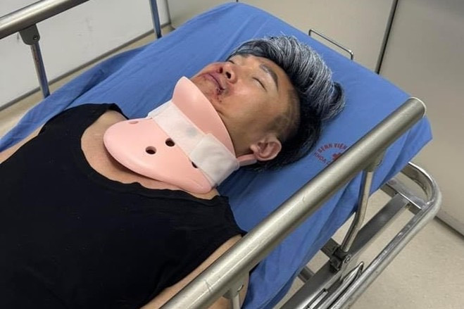 Du Thiên được đưa cấp cứu tạm thời.