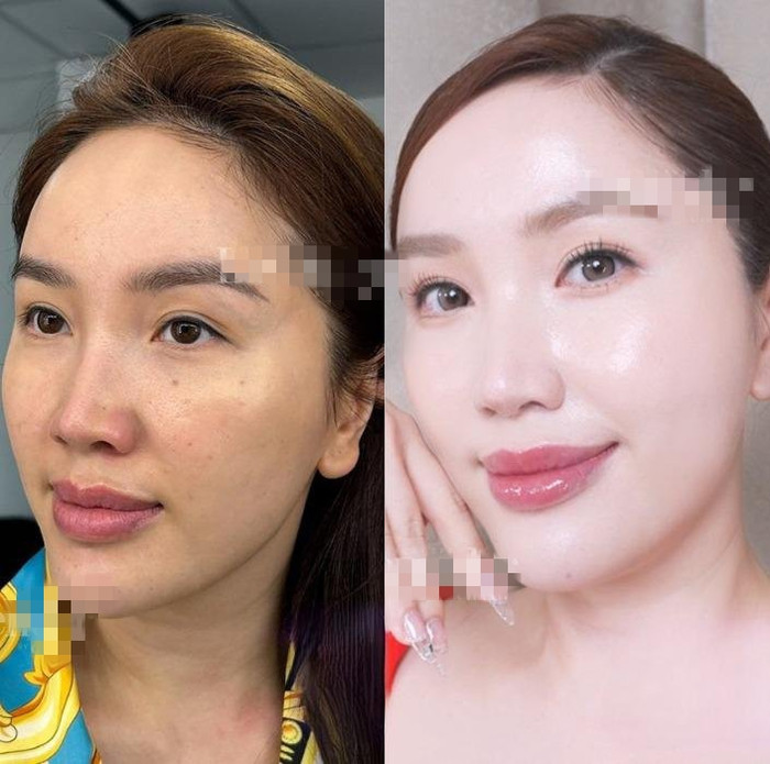 Trong khung hình quay cận, mặt mộc của cô xuất hiện nhiều dấu vết thời gian như sạm, lỗ chân lông to, tàn nhang,…  