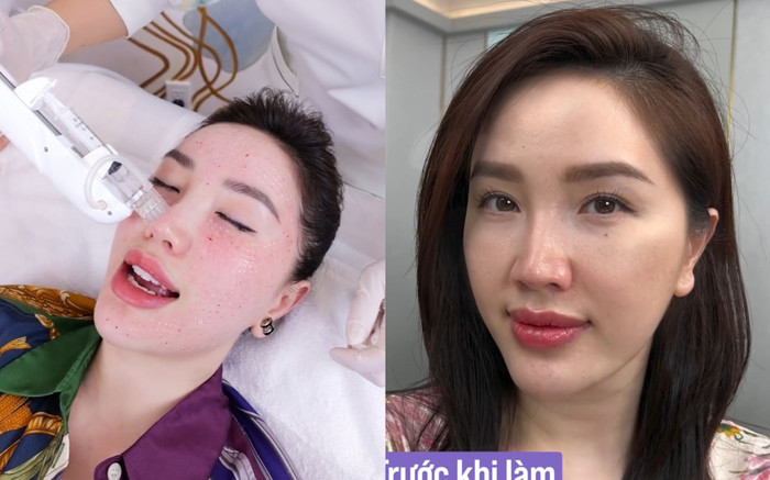 Bảo Thy trùng tu nhan sắc Ảnh 2