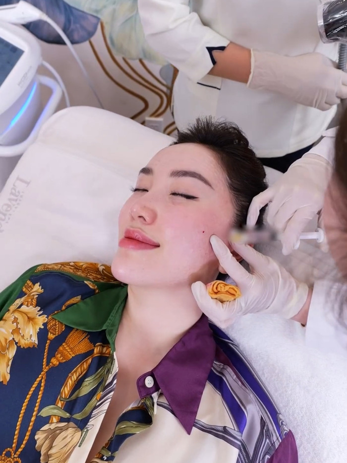  Bảo Thy tiết lộ: “Làm xong da không bị bong tróc, đóng vảy hay mẩn đỏ gì cả nên Thy không cần hủy sự kiện, vẫn hoạt động bình thường và gặp gỡ mọi người...”.  