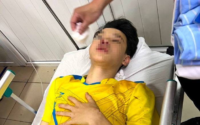 Trên đường đi thi lớp 10, nam sinh va chạm với xe ô tô phải bỏ thi môn cuối cùng Ảnh 2