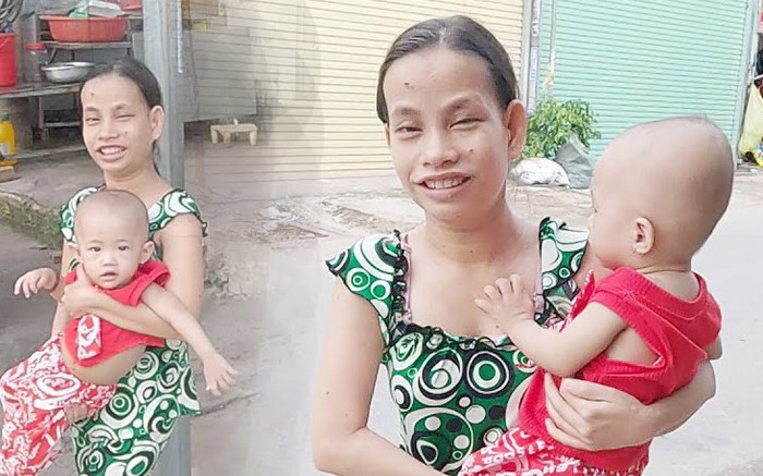 Cô gái tí hon nặng 25kg làm mẹ đơn thân khiến ai gặp cũng thương xót Ảnh 2