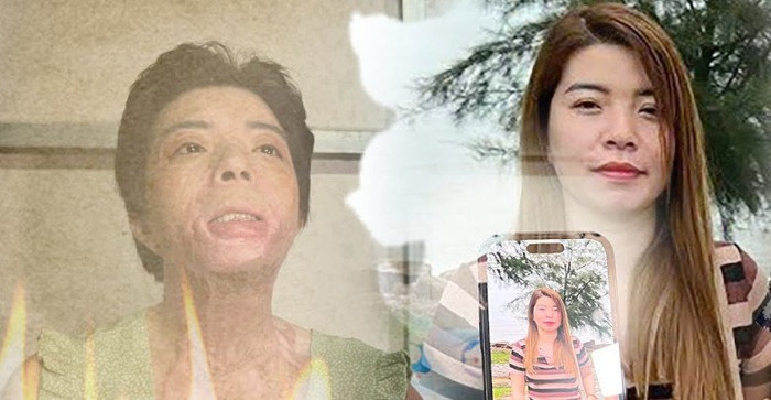 Hình ảnh trước và sau khi gặp tai nạn của chị Đào