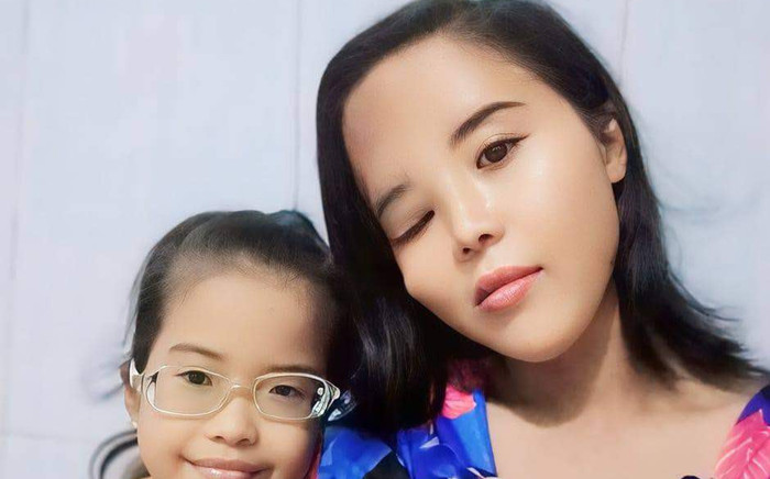 Cô gái 'xấu đau xấu đớn' bị chồng ruồng bỏ, thiên hạ cời cợt giờ ra sao? Ảnh 2