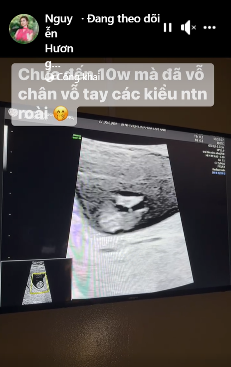 Hương Giang khoe bé con gần 10 tuần trong bụng