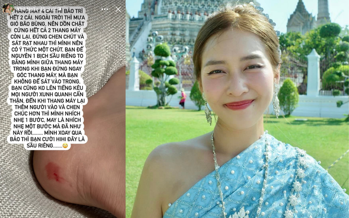 Khả Ngân chia sẻ về sự cố vừa gặp phải.