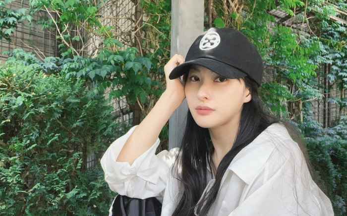 Nữ ca sĩ xinh đẹp bị gãy xương nghiêm trọng ở xương gò má và hốc mắt, tình trạng gây lo lắng Ảnh 2