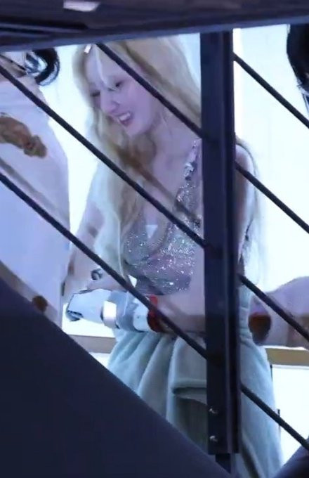 Thành viên BABYMONSTER gặp chấn thương khi đi diễn khiến người hâm mộ lo lắng Ảnh 2