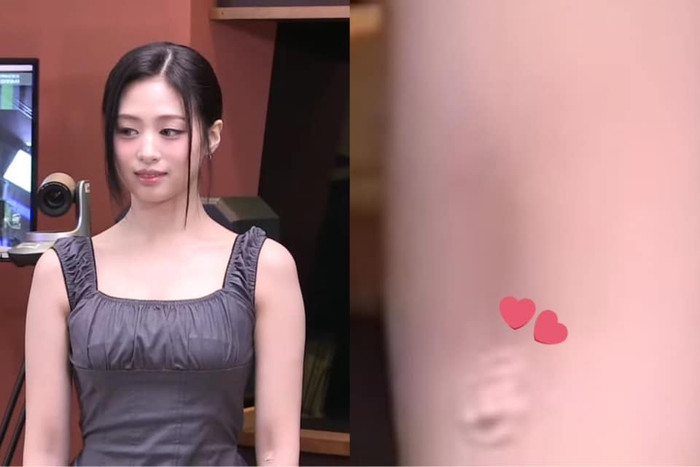 Thành viên BABYMONSTER gặp chấn thương khi đi diễn khiến người hâm mộ lo lắng Ảnh 3