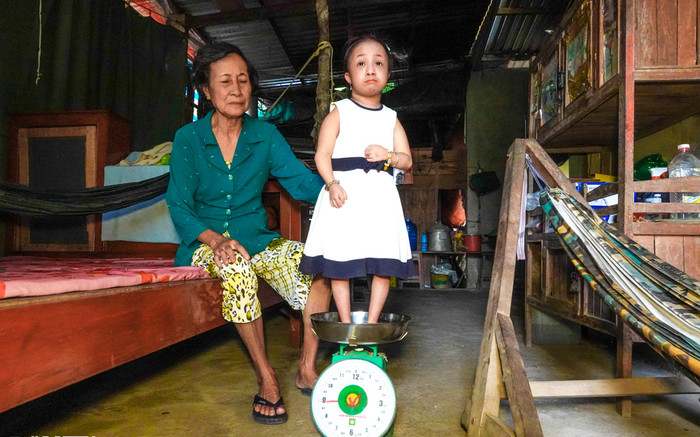 Bé gái chào đời chỉ bằng chiếc ly uống nước, 12 tuổi nặng 7kg giờ ra sao? Ảnh 2