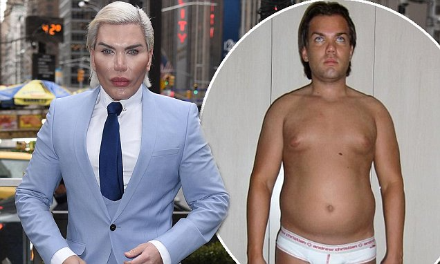 Hình ảnh trước và sau khi thẩm mỹ của Rodrigo Alves (Ảnh: Daily Mail)