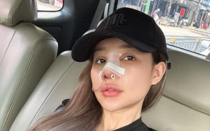 Ngân 98 tiếp tục phẫu thuật thẩm mỹ để tránh 'tướng phu thê' với Lương Bằng Quang Ảnh 2