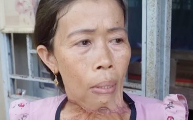 Người phụ nữ xinh đẹp bỗng dưng thành bà già, da thịt dính vào nhau Ảnh 2