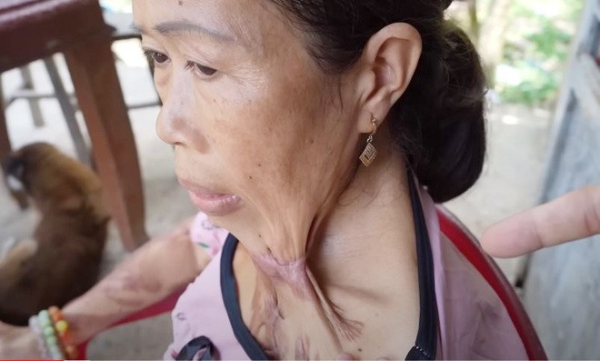 Vì cuộc sống mưu sinh nên chị chấp nhận chịu đau đớn