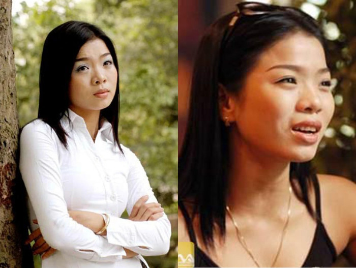 Nhan sắc Lệ Quyên trước khi phẫu thuật gắn sụn mũi. 