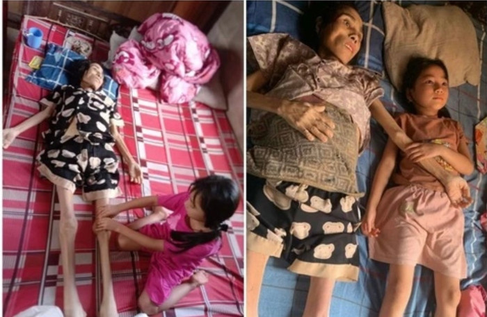 Bảo Nhi chăm sóc mẹ bị bệnh ung thư.