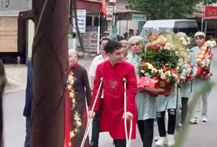 Đám hỏi 'vượt ngàn chông gai', chú rể chống nạn đi hỏi vợ và cái kết bất ngờ Ảnh 2