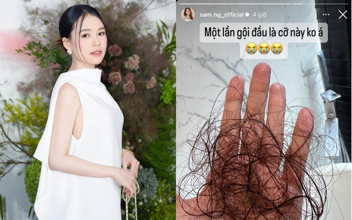 Sam lo lắng về tình trạng rụng tóc sau khi sinh con. Ảnh: FBNV