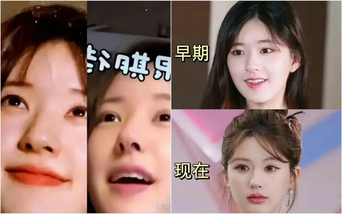 Triệu Lộ Tư bị đặt nghi vấn về chiếc mũi nhỏ bất thường. 