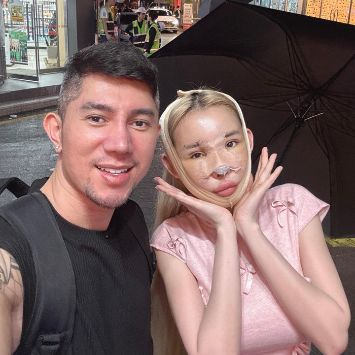 Ngân 98 thực hiện phẫu thuật thẩm mỹ.