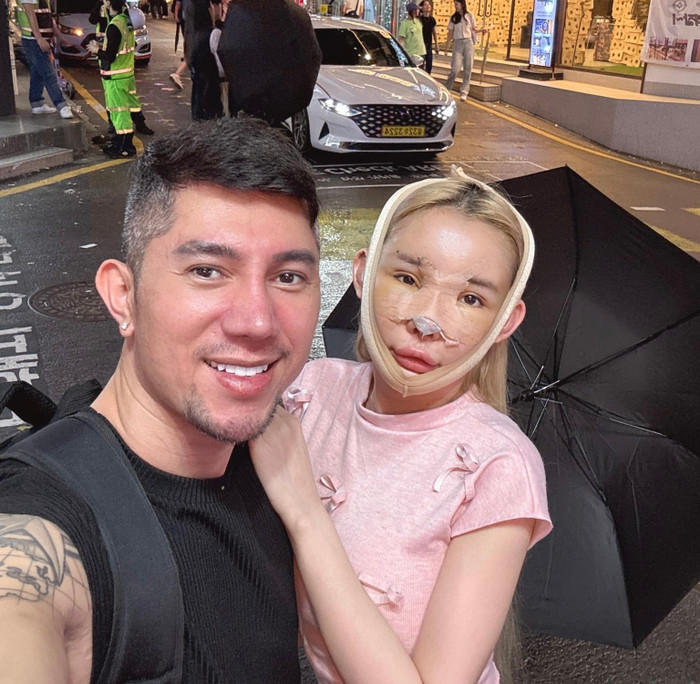 Cô nâng mũi, tháo hàm với chi phí khủng.