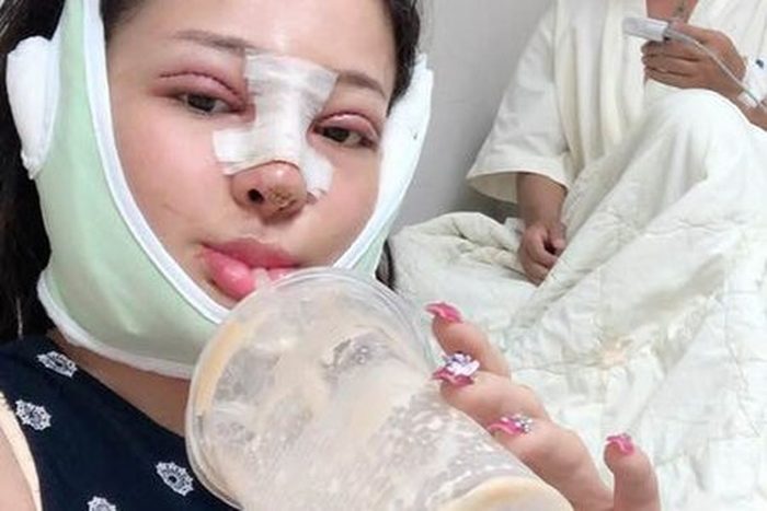 Nhan sắc thời chưa phẫu thuật thẩm mỹ của Ngân 98 gây bất ngờ Ảnh 5