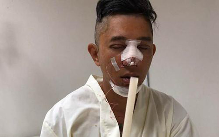 Diện mạo Lương Bằng Quang trước khi phẫu thuật thẩm mỹ cùng Ngân 98 Ảnh 2