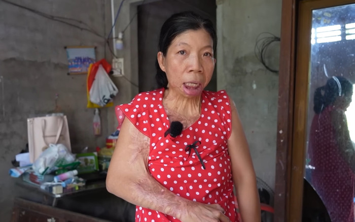 Người phụ nữ Vĩnh Long suốt 20 năm không có nụ cười, nghe lý do thật xót xa Ảnh 2