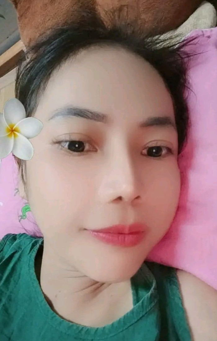 Duyên Phạm tự tin khoe chiếc mũi sau 5 năm phẫu thuật