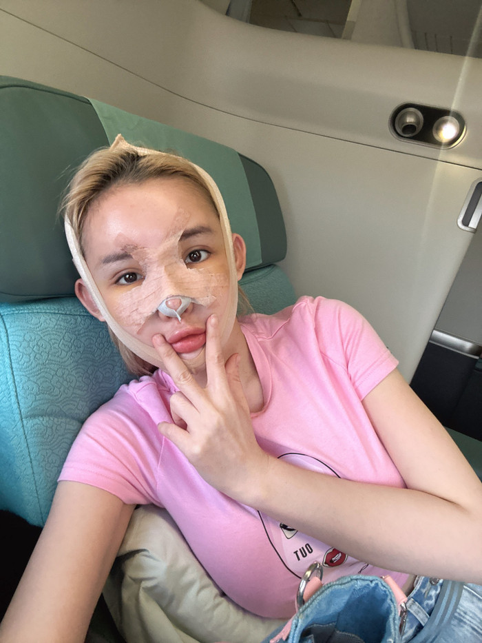 Ngân 98 háo hức chờ đợi kết quả sau khi vừa qua nước ngoài sửa mũi.  