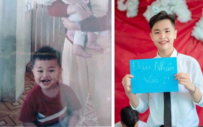 Cha mẹ bỏ rơi ở chân cầu vì dị tật, bạn bè trêu chọc, chàng trai bất ngờ tái sinh hình hài mới sau 18 năm Ảnh 2