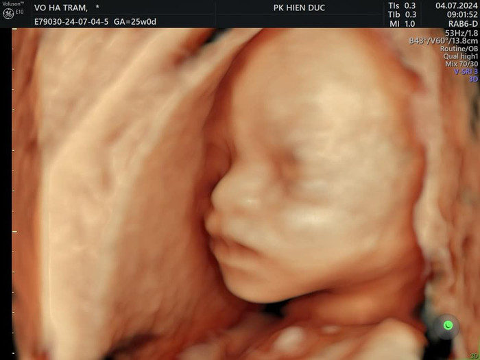 Võ Hạ Trâm khoe cận ảnh siêu âm con thứ 2, 'sao y bản chính' của chồng Ấn Độ Ảnh 1