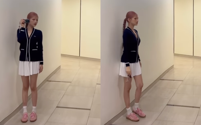 Xoài Non diện váy ngắn vô tình để lộ đôi chân gầy gò, thiếu sức sống. Ảnh: Chụp màn hình