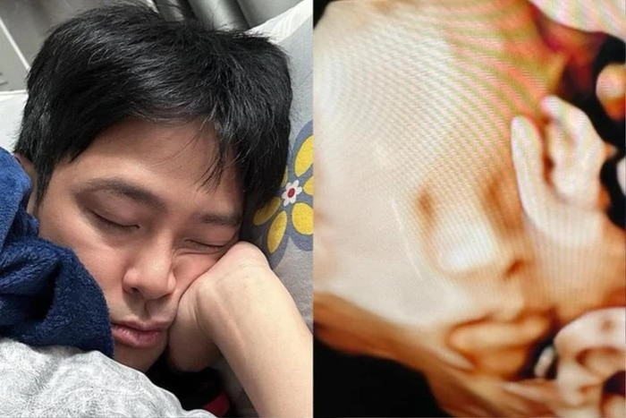 Nữ diễn viên hài hước cho biết cô nhập hội đẻ thuê vì con gái có nét giống với bố. 