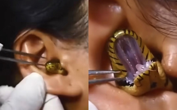 Clip người phụ nữ bị con rắn chui vào tai khi ngủ khiến ai cũng thót tim Ảnh 2