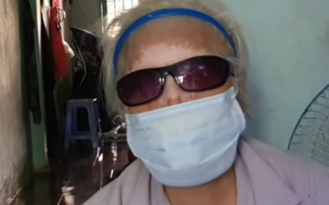 Người phụ nữ bị 'tiểu tam' tạt axit đến biến dạng khuôn mặt Ảnh 2