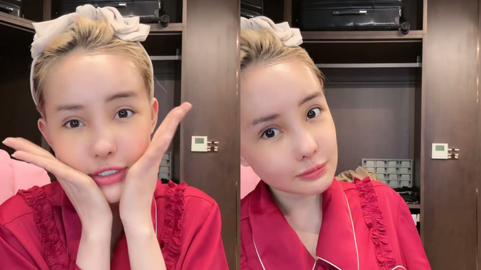 Nhan sắc hiện tại của Ngân 98 được đánh giá hiền lành hơn trước, cô cũng đã tháo cằm nên nhìn gương mặt có phải trẻ trung, bầu bĩnh hơn hẳn.&nbsp;