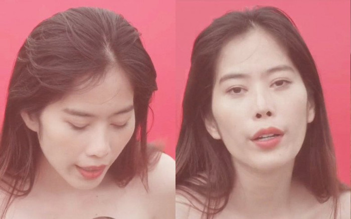 Tác hại từ phương pháp thẩm mỹ phần mắt mà Nam Em từng thực hiện Ảnh 2