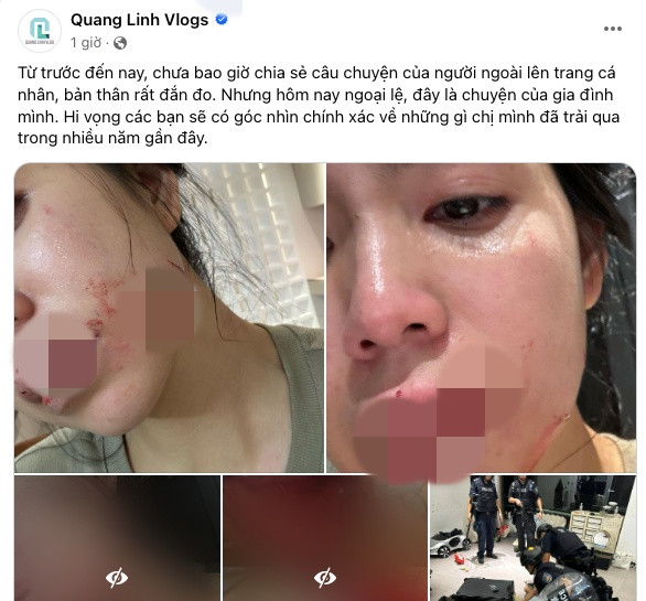 Bài viết của Quang Linh Vlogs gây chú ý