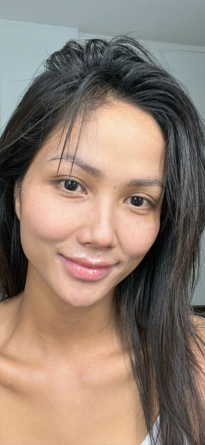 Hiện tại, H'hen Niê đã có làn da khỏe khoắn hơn tuy nhiên ít ai biết rằng cô nàng đã có một khoảng thời gian khốn đốn vì sử dụng kem trộn không rõ nguồn gốc có chứa corticoid.