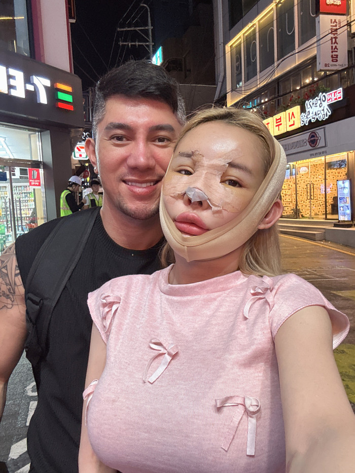 Lương Bằng Quang là người đồng hành, hỗ trợ Ngân 98 khi sửa mũi tại Hàn Quốc. 